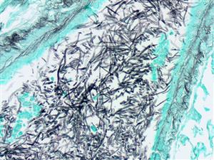 4220A | Control Slides:Histopathology; Fungus, GMS, Aspergillus sp., Artificial